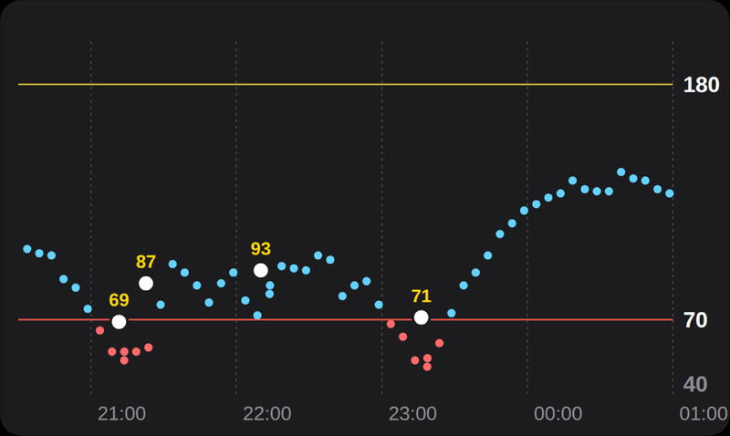My glucose chart from 9 PM to 1 AM: sensor readings dip under 70 twice, with four calibration points from my meter at 69, 87, 93, and 71, each above the sensor line.