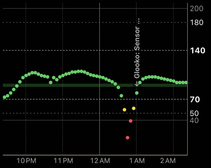 My glucose chart: steady in range, a sudden drop to readings under 50 around 12:45 AM, then straight back to about 110.